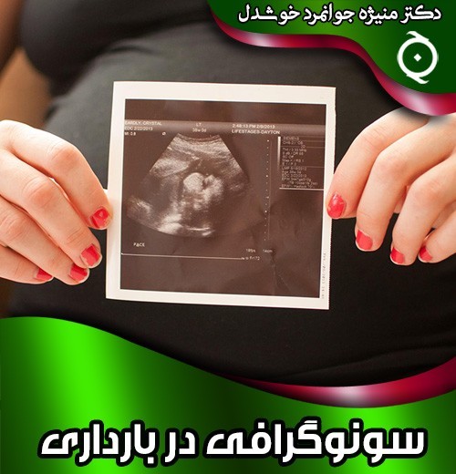 سونوگرافی-در-بارداری