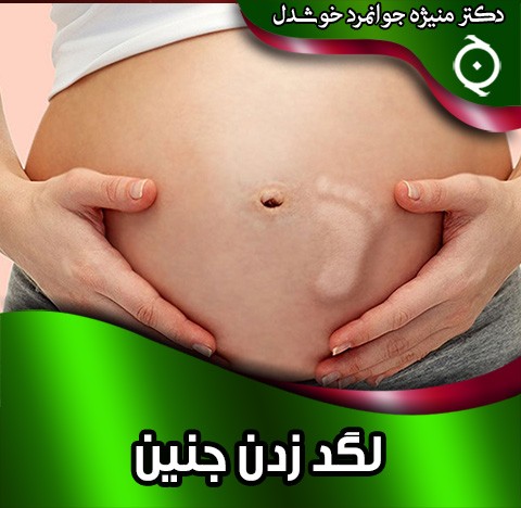 لگد زدن جنین در بارداری دوقلویی