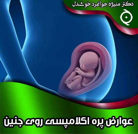 عوارض پره اکلامپسی روی جنین