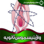 واژینیسموس-ثانویه