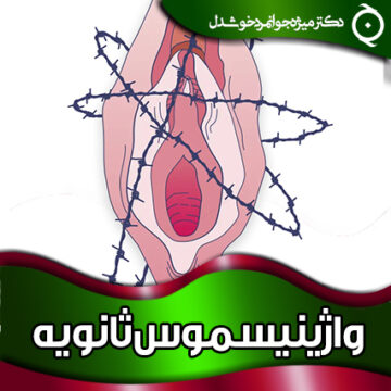 واژینیسموس-ثانویه