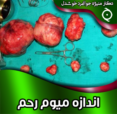 اندازه-میوم-رحم