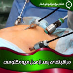 مراقبتهای-بعد-از-عمل-میومکتومی