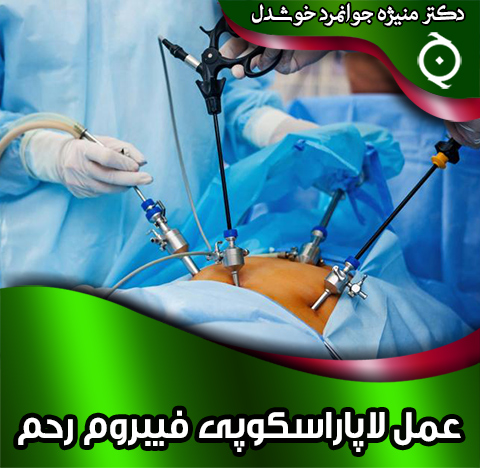 عمل-لاپاراسکوپی-فیبروم-رحم