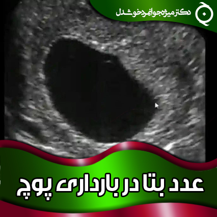 عدد-بتا-در-بارداری-پوچ
