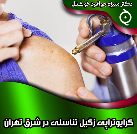 کرایوتراپی-زگیل-تناسلی-در-شرق-تهران