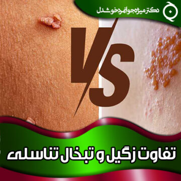 تفاوت-زگیل-و-تبخال-تناسلی